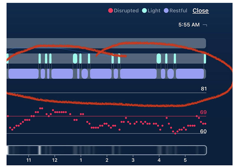 A Better Night Sleep with REST Softgels... the data is here to prove it!